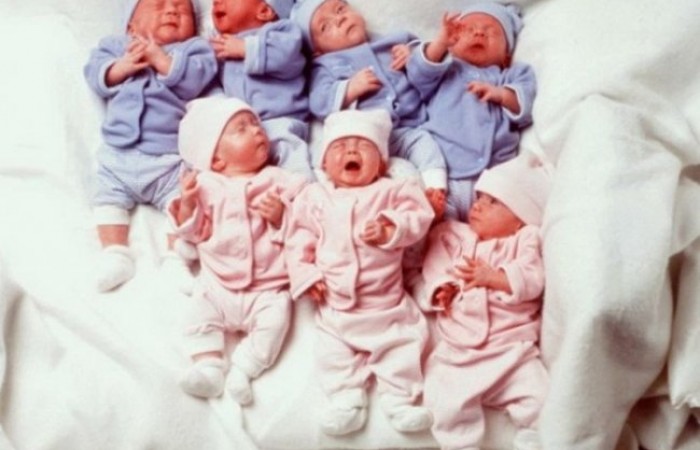 Первым в мире близнецам-семерняшкам исполнилось 18 лет (7 фото)