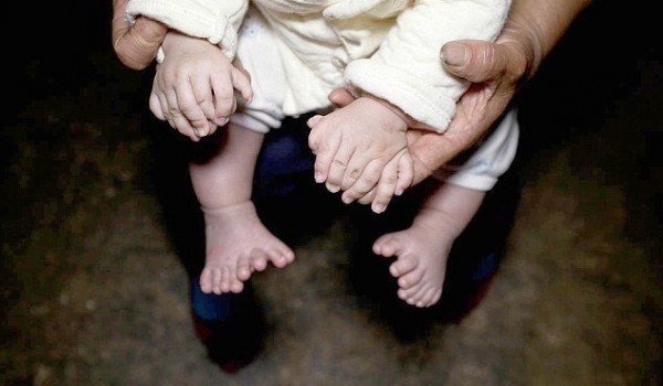 В Китае родился мальчик у которого 31 палец (5 фото)