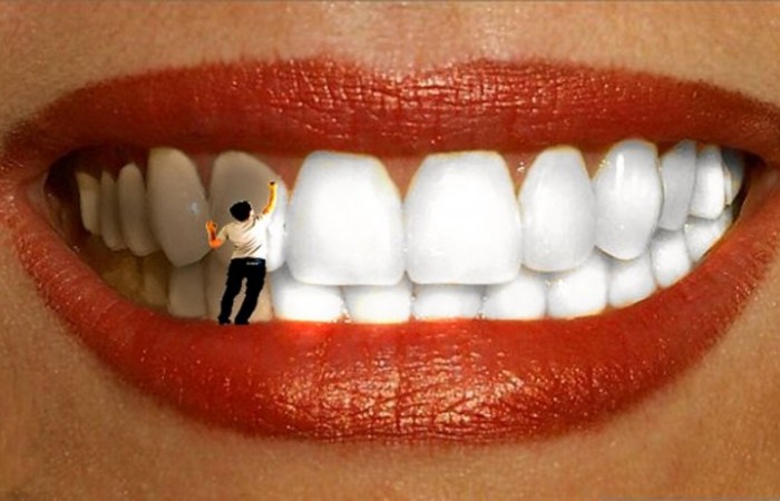 Интересное об отбеливании зубов