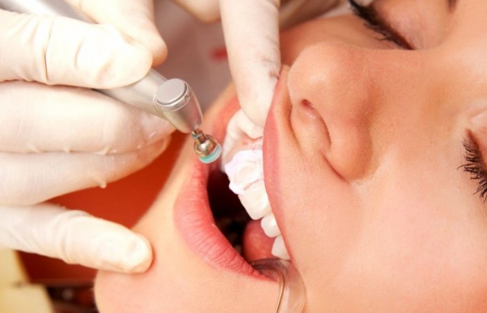 Преимущества и особенности ультразвуковой чистки зубов