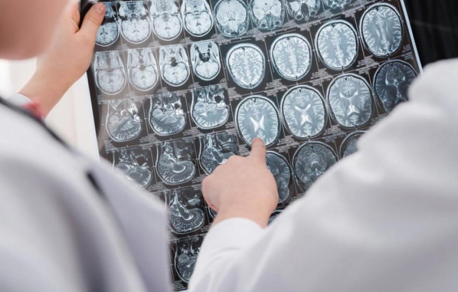 Некоторые функции мозга можно восстановить после смерти