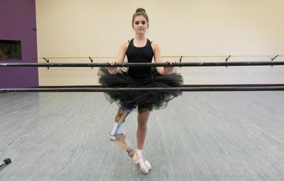 Девушка с протезом ноги стала прекрасной танцовщицей (8 фото)