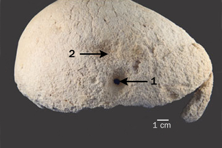 В Африке 3000 лет назад тоже делали трепанацию черепа (2 фото)