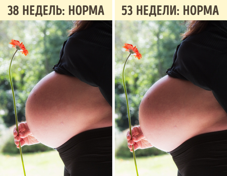 9 странных, но правдивых фактов о беременности
